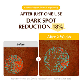 EQQUALBERRY mask edges fitting face to prevent evaporation and increase uptake