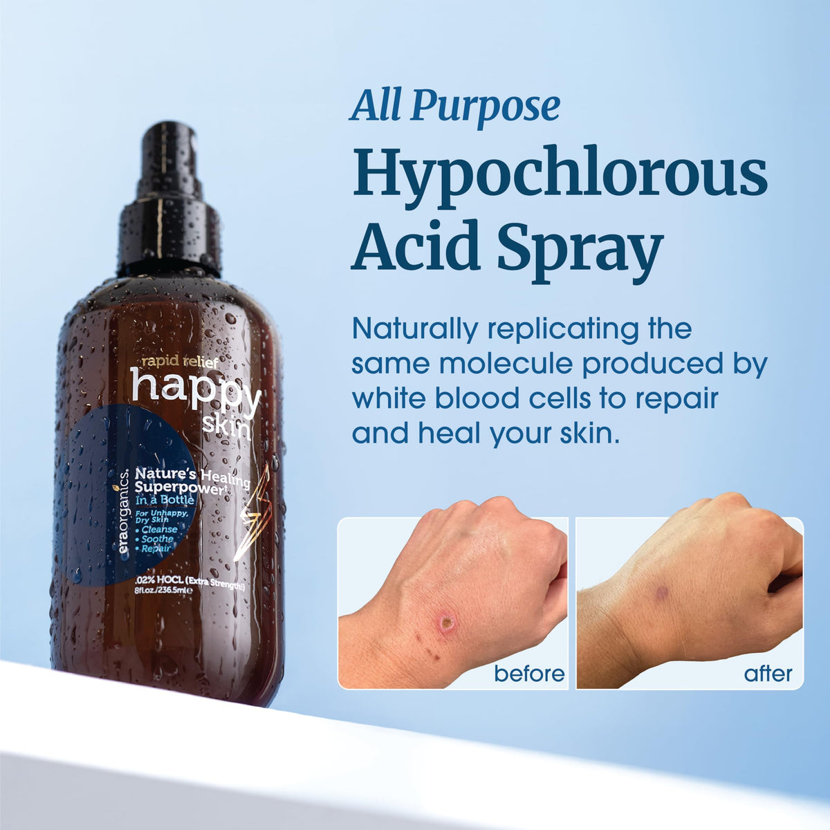 Era Organics misting spray in hand demonstrating easy application and soothing effect