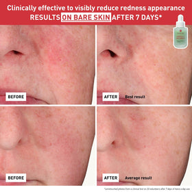 Erborian Centella Red Serum in daylight lifestyle setting for gentle care