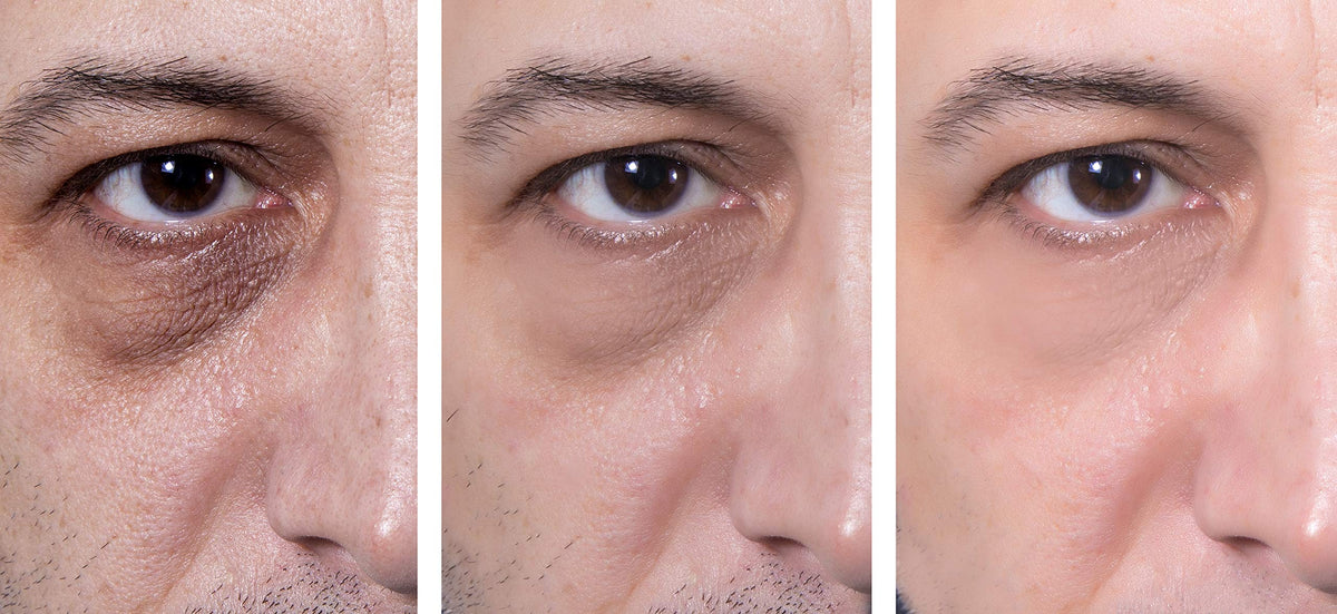 Essence Of Arcadia demo applying gel under eye to reduce puffiness and smooth lines