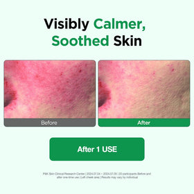ESSENHERB tea tree ingredient display highlighting deep pore support