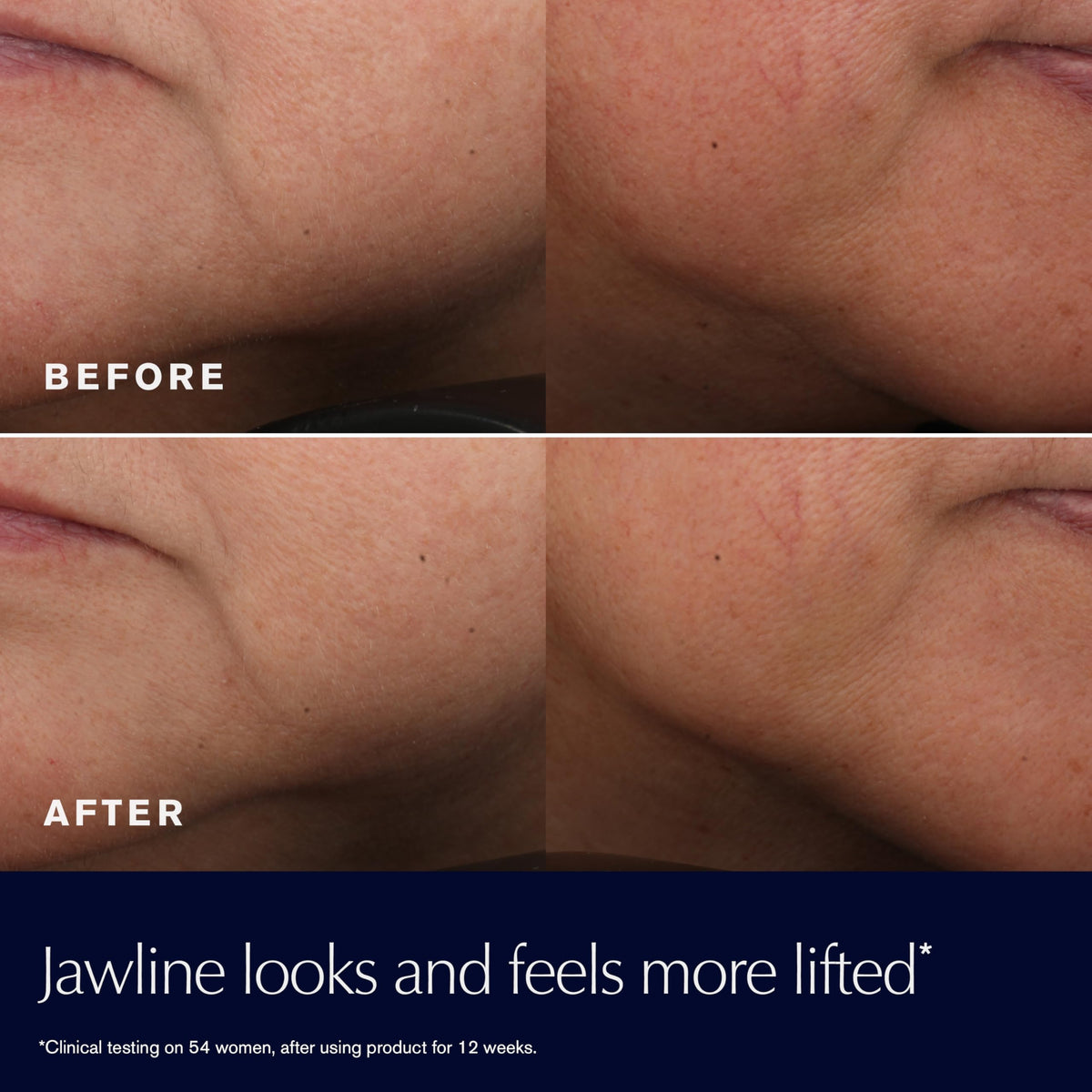 Estée Lauder face and neck usage lifestyle photo demonstrating targeted lifting benefit