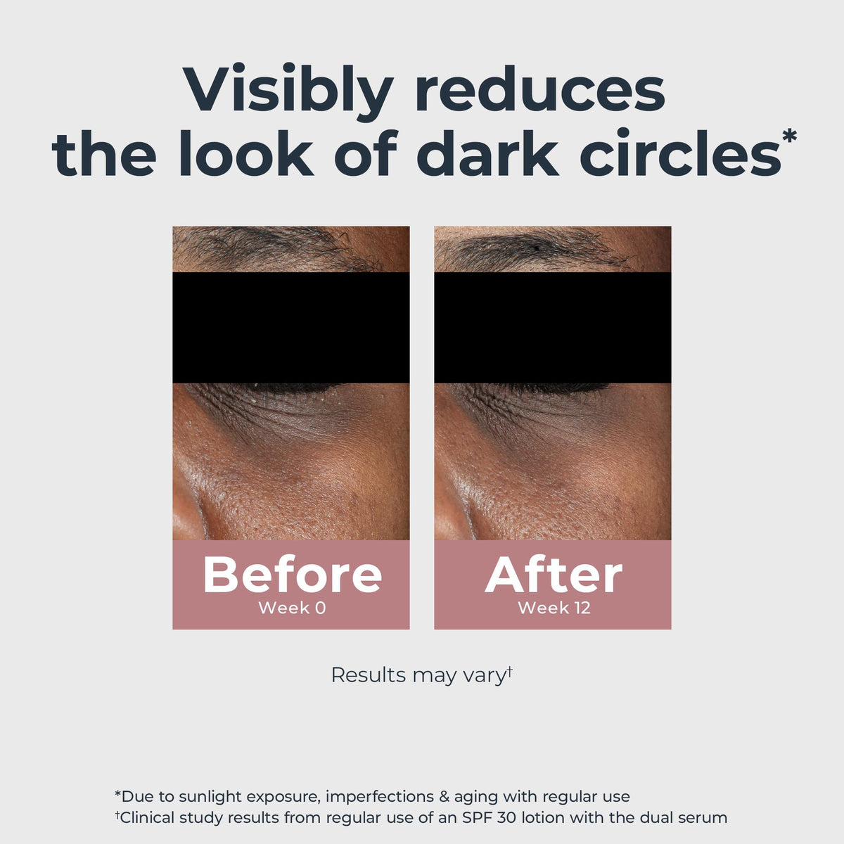 eucerin eye cream applied under eye illustrating immediate brightening