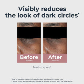 eucerin eye cream applied under eye illustrating immediate brightening