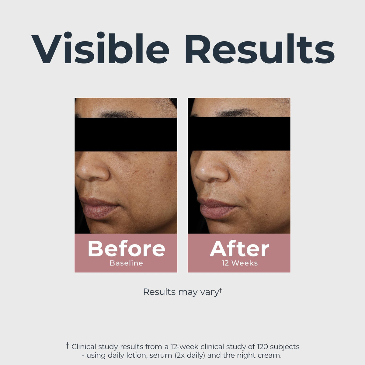 Applying Eucerin night cream to cheek for targeted dark spot care benefit
