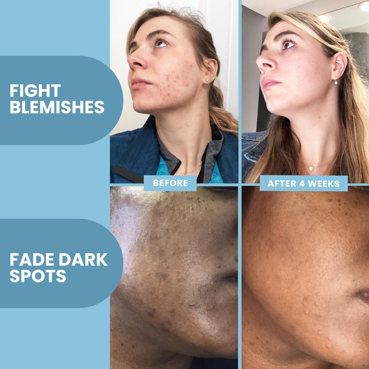 Eva Naturals applying serum to cheek, illustrates targeted spot treatment benefit