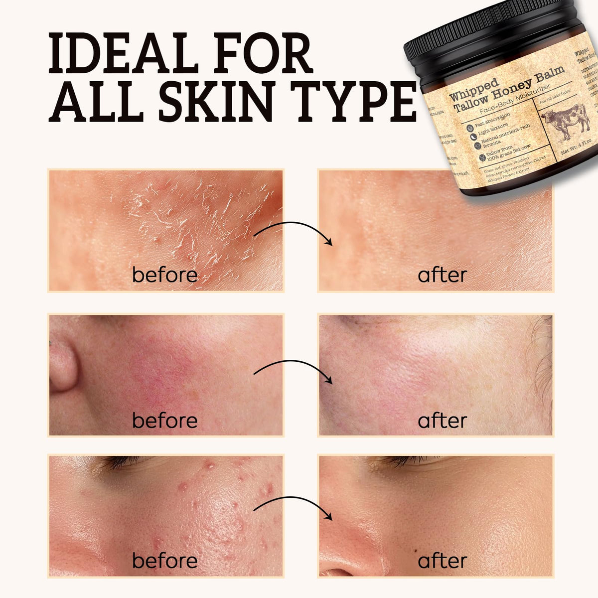Before and after hands using Evervines balm showing softer, repaired skin