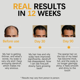 Styled hair after using Excalvo showing thicker, shinier hair benefit