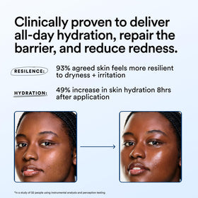 Experiment in-use application on cheek illustrating soothing, non-greasy hydration
