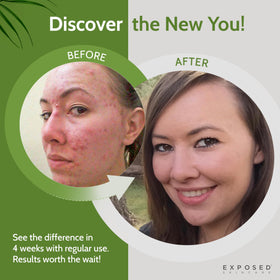 Exposed Skin Care sage and provitamin B5 ingredients portraying calming benefits
