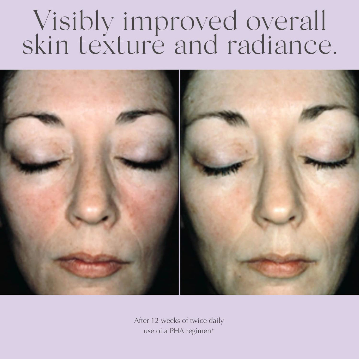 EXUVIANCE product staged on nighttime bathroom counter for routine benefit