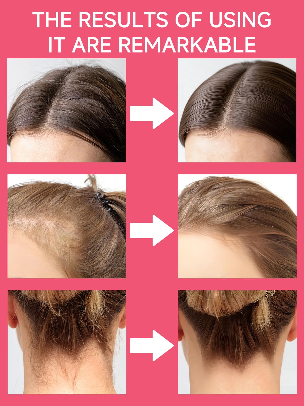 FAMIKYA applied along hairline smoothing edges for a polished look