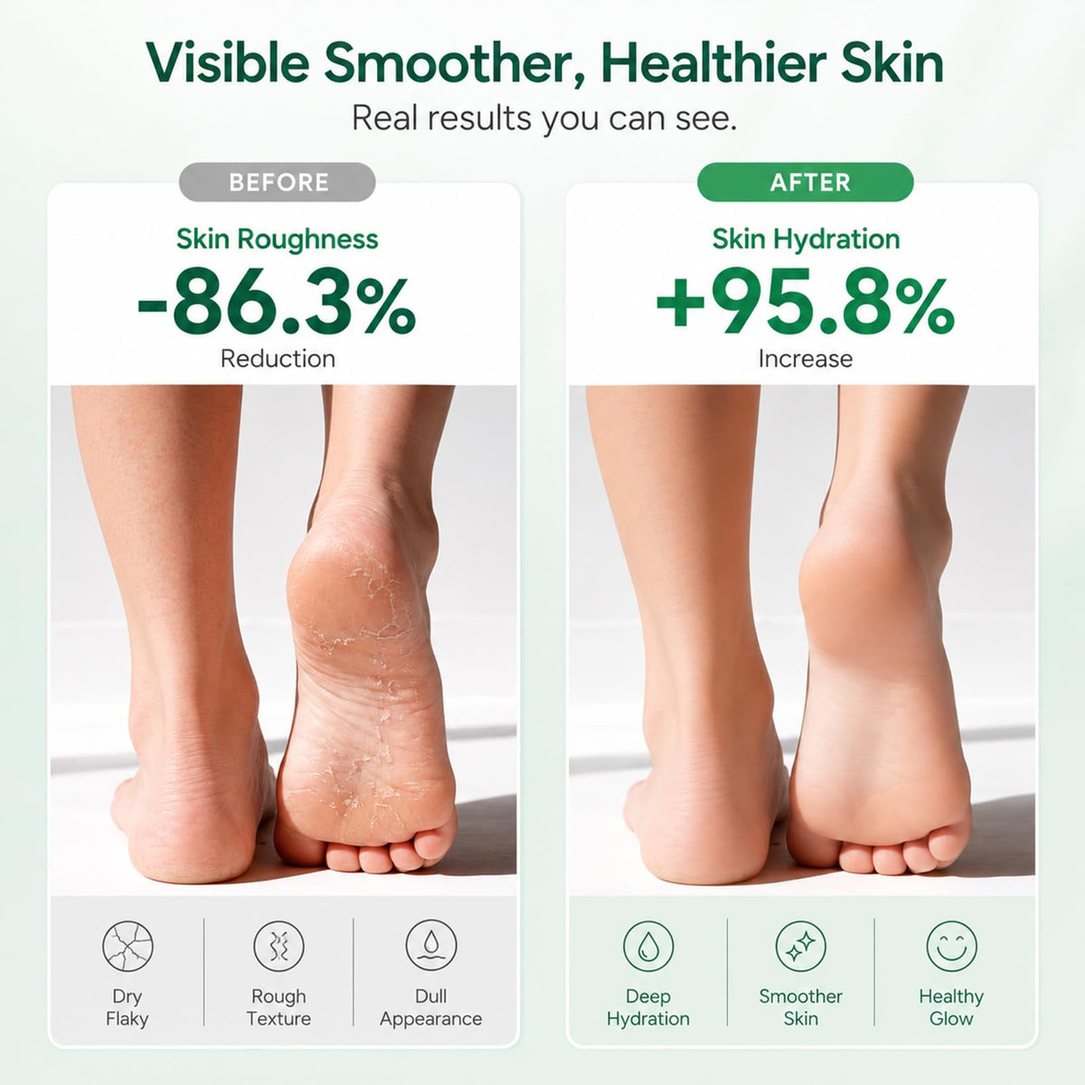 FAMIKYA visible before and after heels comparison showing improved skin texture