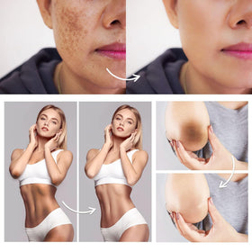 FAMIROSA cream being applied to underarm for smoother, hydrated skin