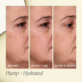 Farmacy before and after skin comparison suggesting visible plumping benefit