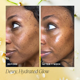 Honey and chamomile ingredients next to bottle, highlights soothing benefit