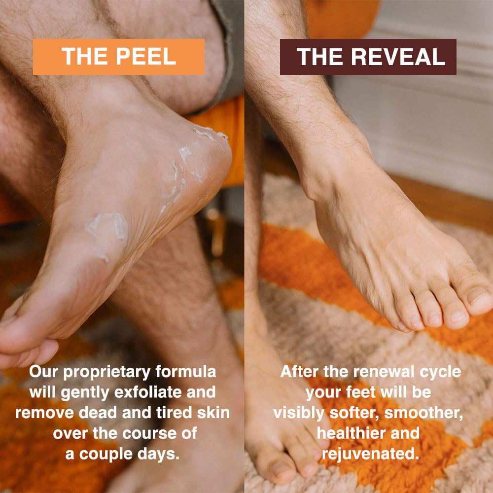 FEETS feet before and after treatment showing softer smoother heels