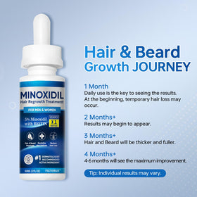 FIGTORUS applied to thinning scalp area demonstrating focused treatment benefit