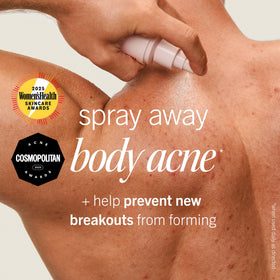 First Aid Beauty nozzle close-up highlights 360° sprayer benefit for reach