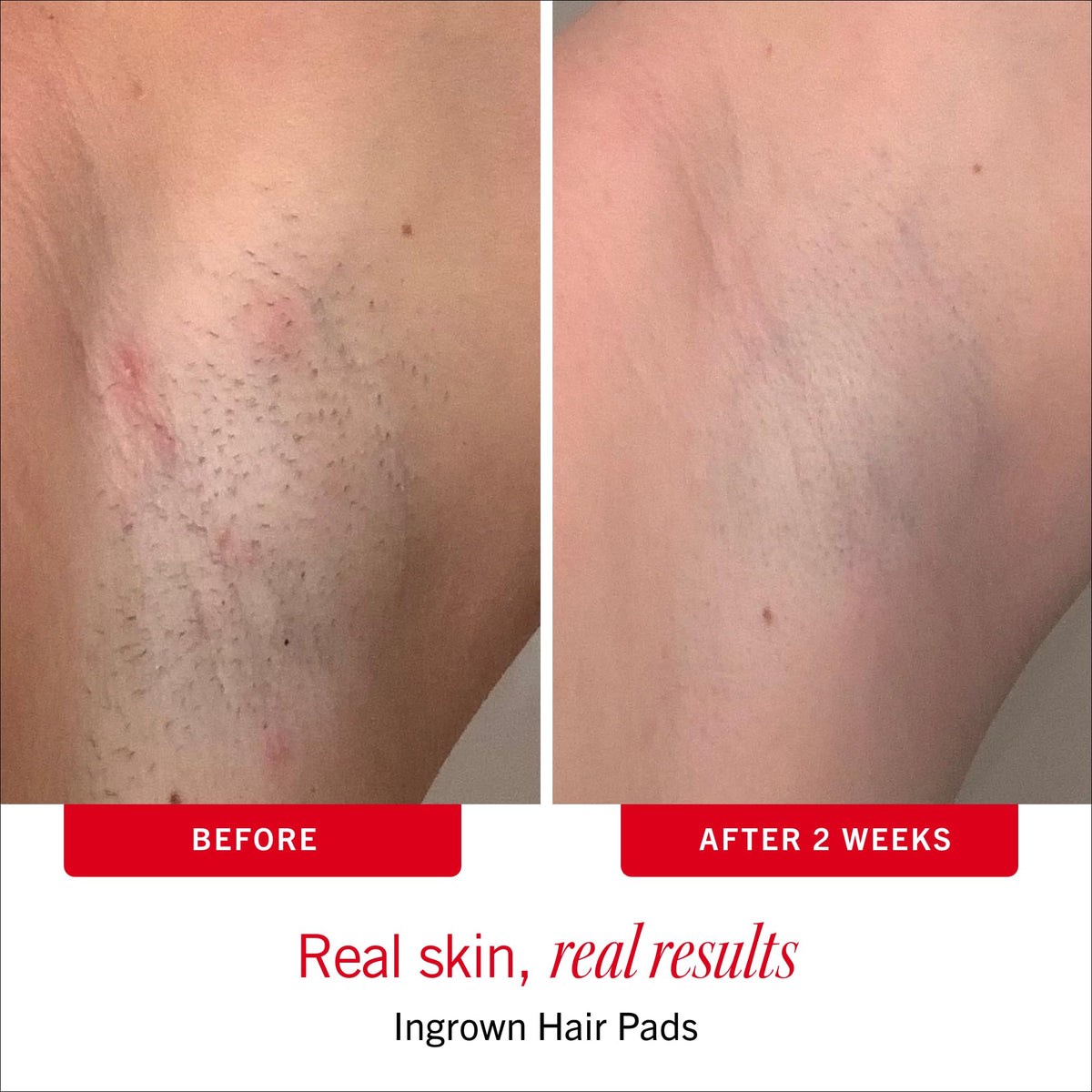 First Aid Beauty label closeup highlighting 10% AHA ingredients