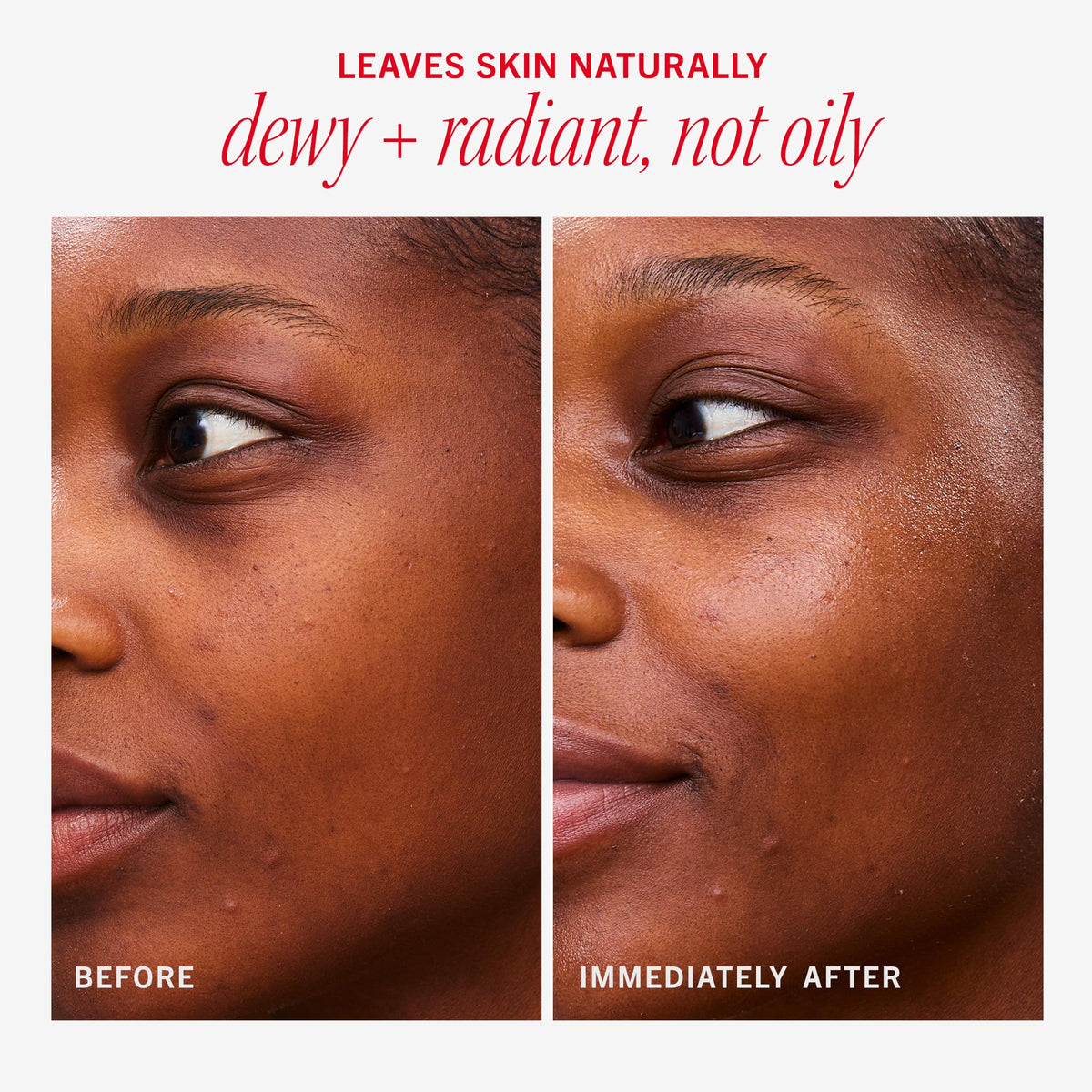 First Aid Beauty product spread on skin before and after, illustrates dewy glow