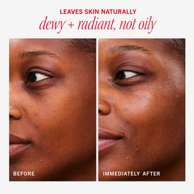 First Aid Beauty product spread on skin before and after, illustrates dewy glow