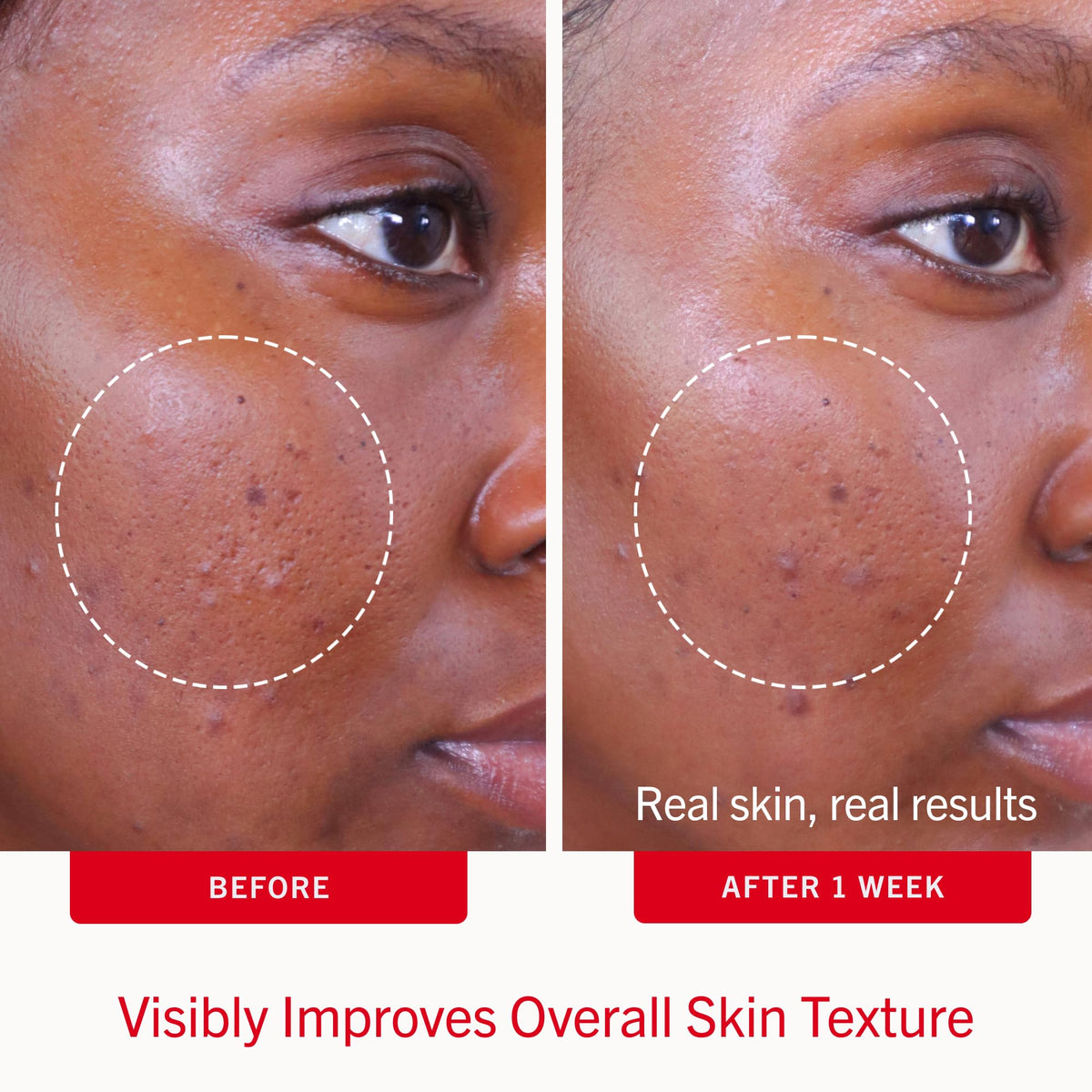 First Aid Beauty pad close-up saturated with treatment for visible active ingredient