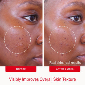 First Aid Beauty pad close-up saturated with treatment for visible active ingredient