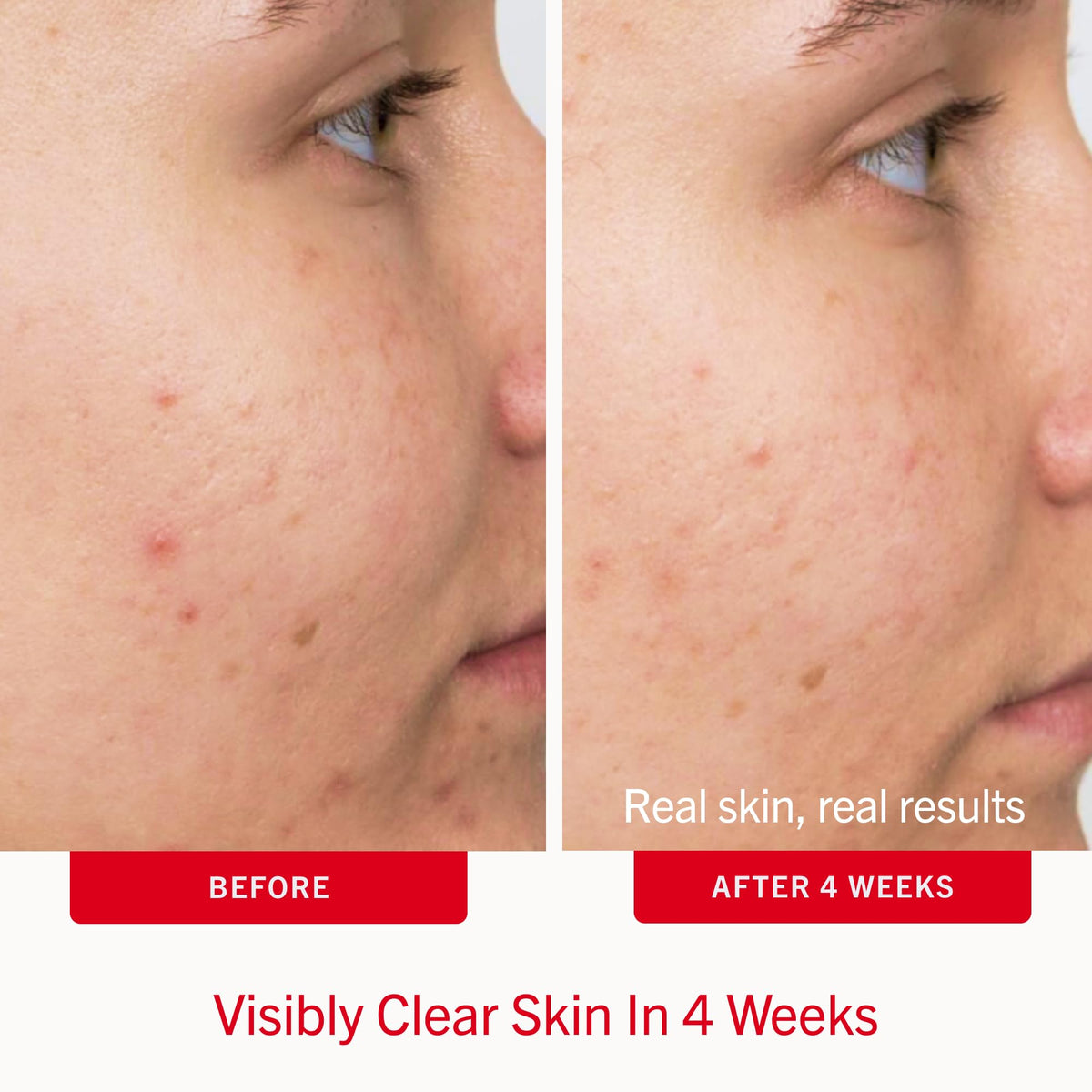 First Aid Beauty pad in hand demonstrating easy, hygienic application