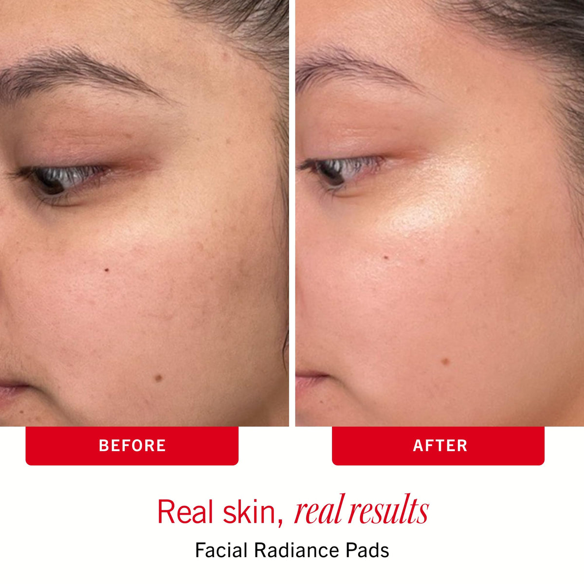 First Aid Beauty dual-sided radiance pads texture close-up for customizable exfoliation
