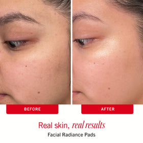 First Aid Beauty dual-sided radiance pads texture close-up for customizable exfoliation