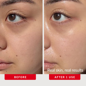 First Aid Beauty close-up label highlighting hyaluronic acid and squalane benefits