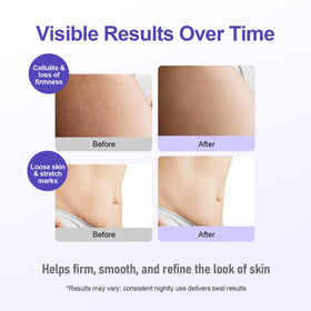 FIUMOT jar label detail highlighting LIFTONIN® and peptide benefits