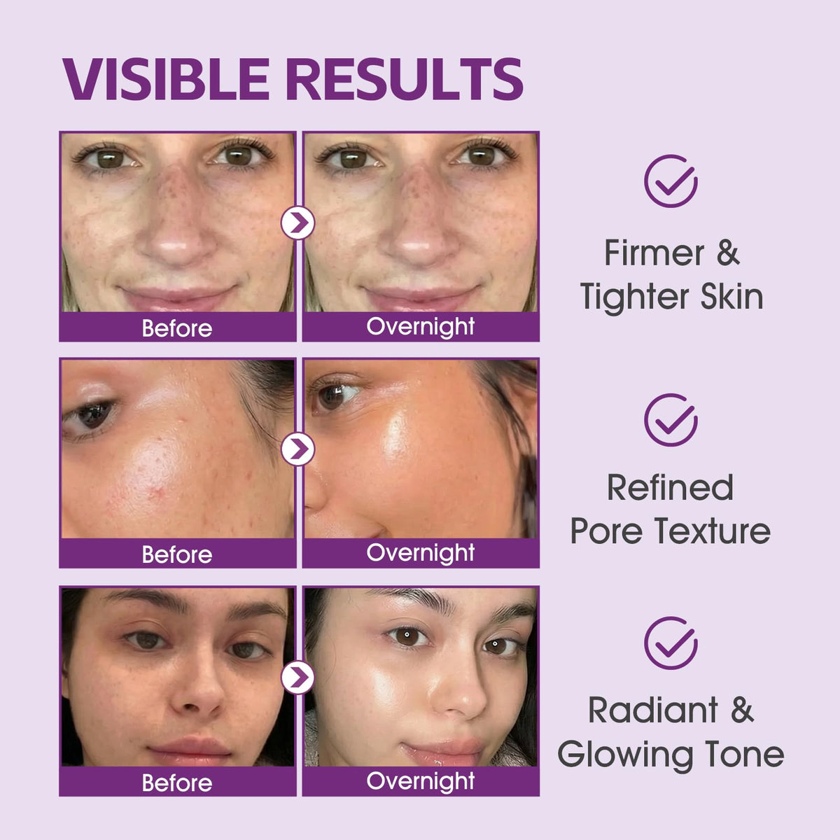 FIVECRAS before and after split face showing firmer skin