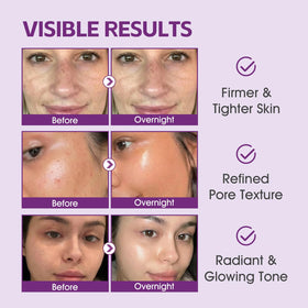 FIVECRAS before and after split face showing firmer skin