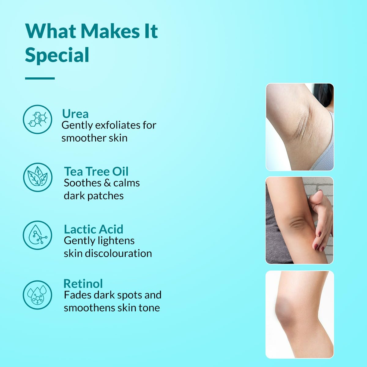 Side-by-side elbow comparison suggesting FIXDERMA helps soften and even tone
