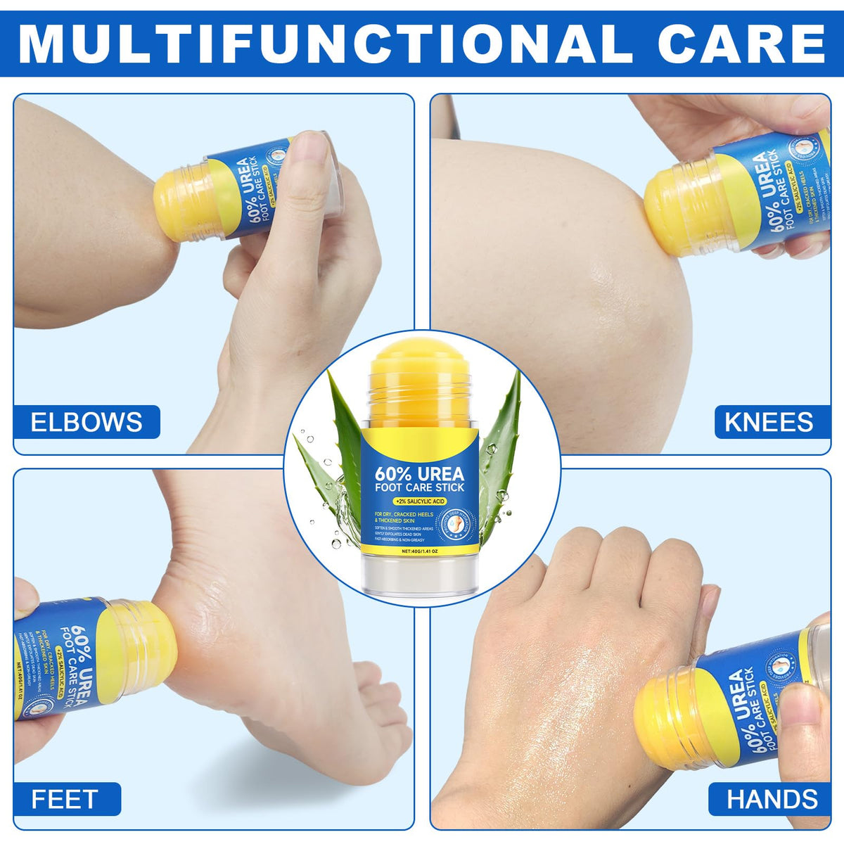 FlameBeauty applying stick to elbow demonstrating targeted rough-skin relief
