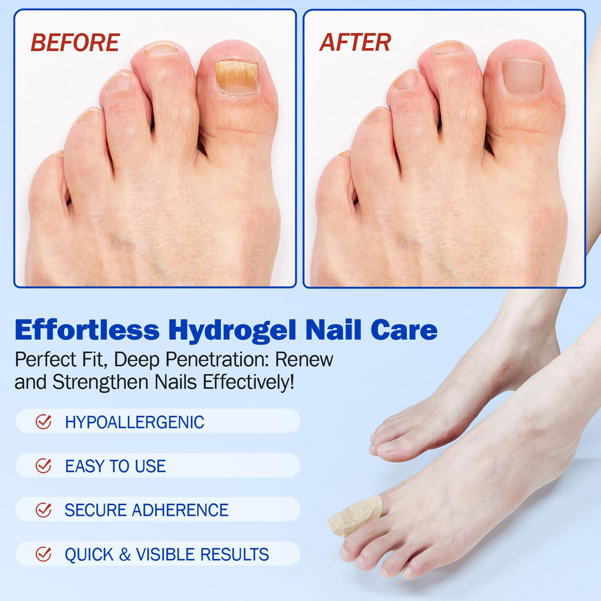 flasture skin-toned patch on toe for discreet, low-visibility wear