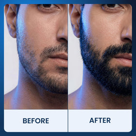Fleava scalp before and after diagram, illustrates reduced shedding and fuller feel