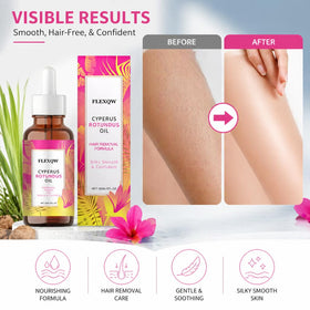 FLEXQW applied underarm to calm irritation and reduce redness