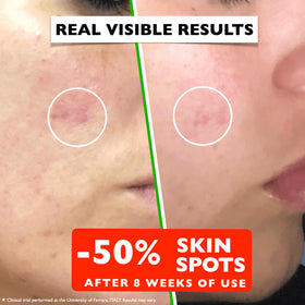 Florence serum applied to neck and face demonstrating hydration and smooth finish