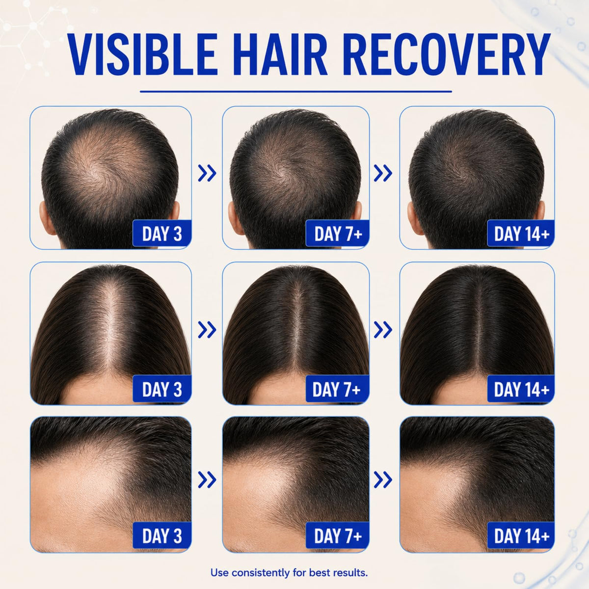 FLYLEAF applying serum to scalp demonstrating targeted root application