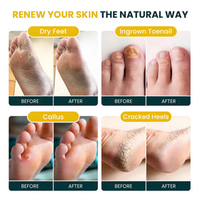 FOOT CURE citrus and botanical pieces detail conveying natural ingredients