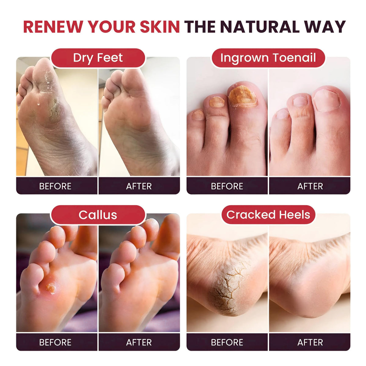 FOOT CURE foot basin in use providing relaxing soak benefit