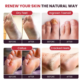 FOOT CURE foot basin in use providing relaxing soak benefit
