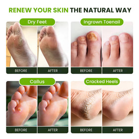 FOOT CURE foot soak in basin demonstrating simple at-home use