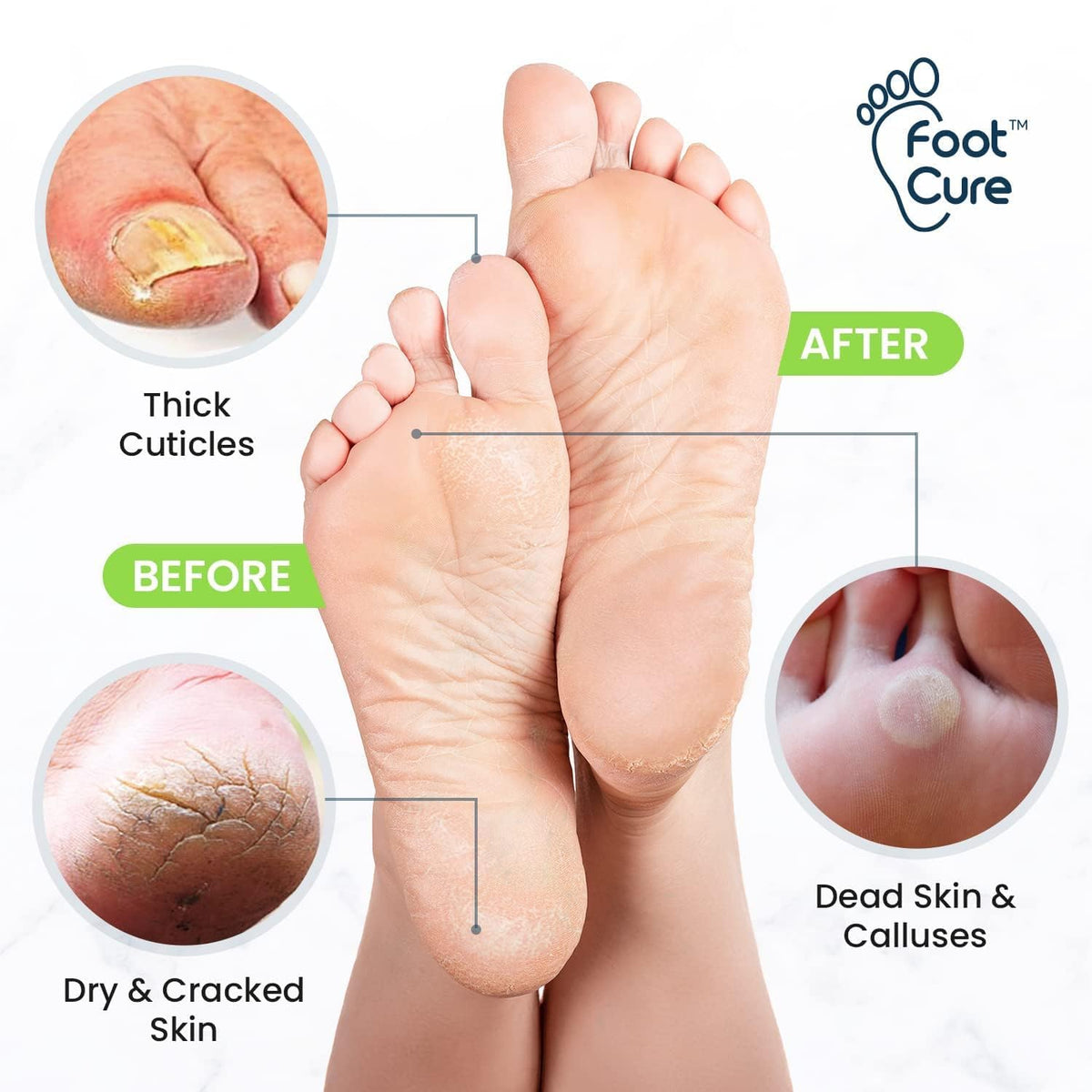 FOOT CURE natural ingredients flatlay highlighting essential oils