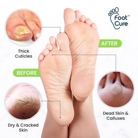 FOOT CURE natural ingredients flatlay highlighting essential oils
