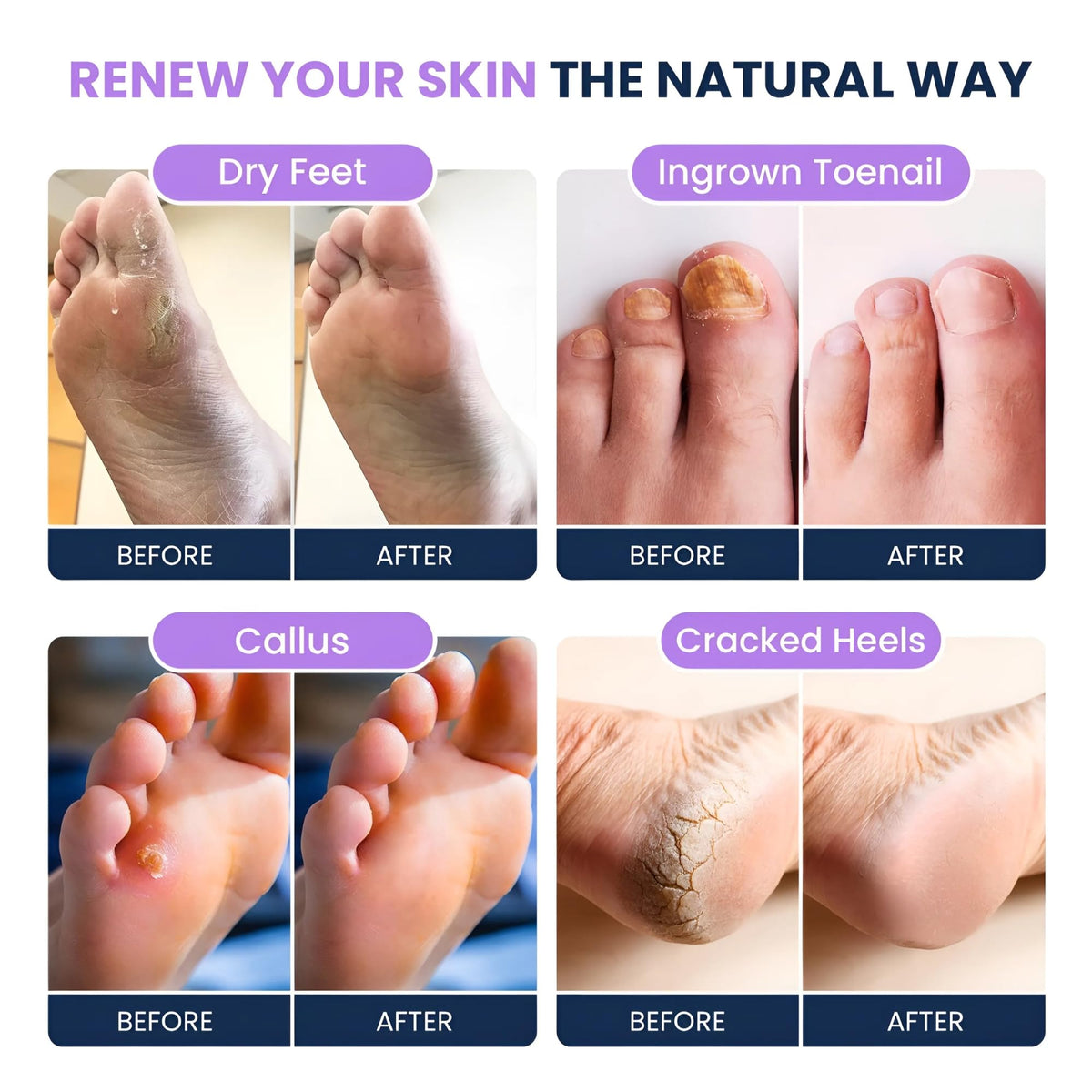 FOOT CURE lavender oil dropper accent highlighting soothing aromatherapy
