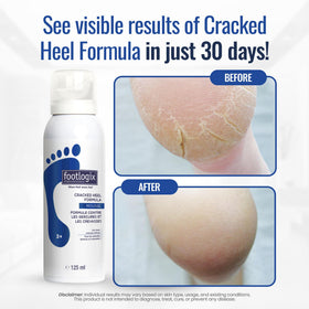 FOOTLOGIX label and contents visible indicating professional strength